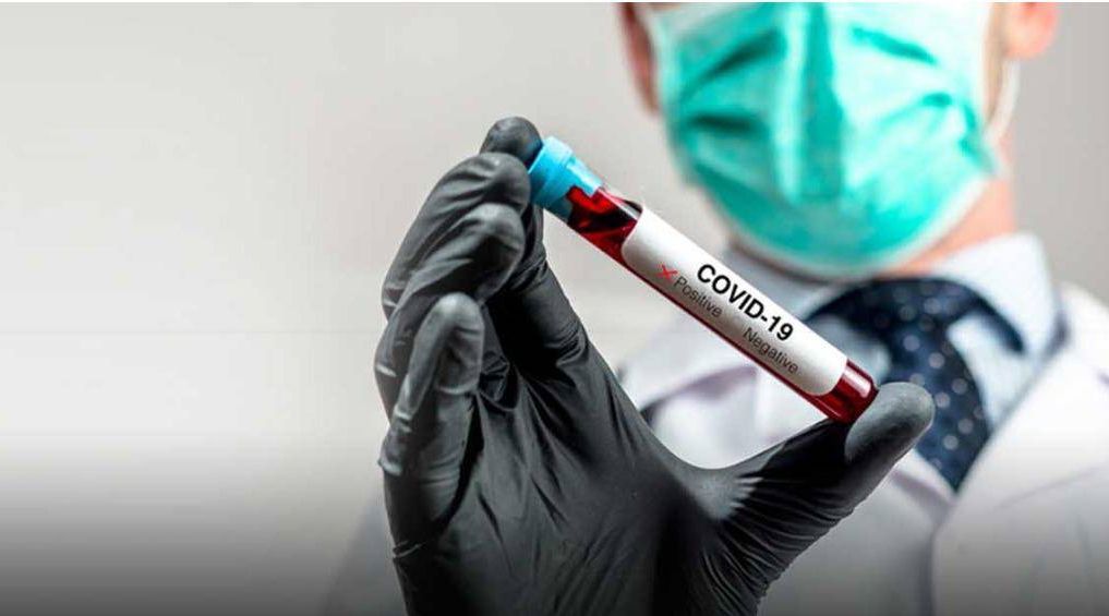 UAE: Antibody test kit to assess COVID-19 vaccine efficacy